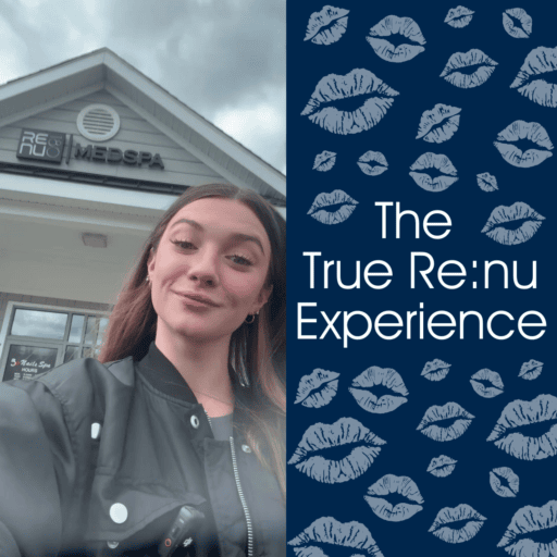 Client Experience | Restylane Lips | Re:nu 180 Medspa
